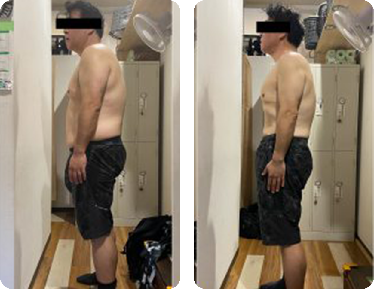 ビフォーアフター