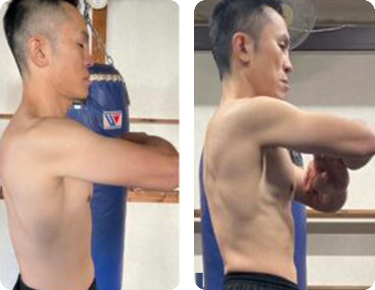 ビフォーアフター