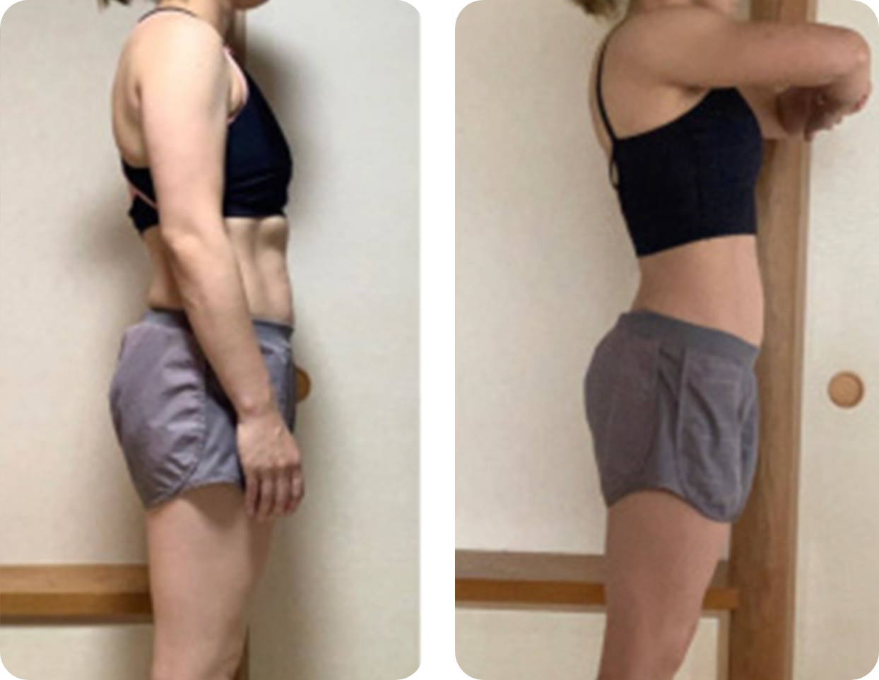 ビフォーアフター