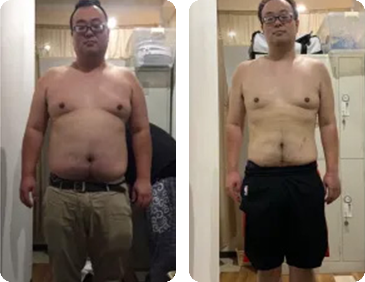 ビフォーアフター