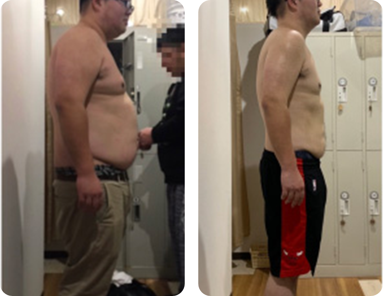 ビフォーアフター