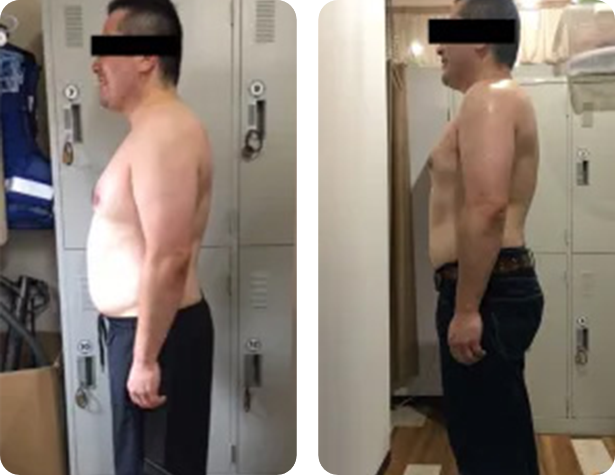 ビフォーアフター